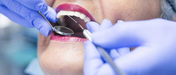 Best Emergency Dental Care for Sports Injuries in Princeton, MO